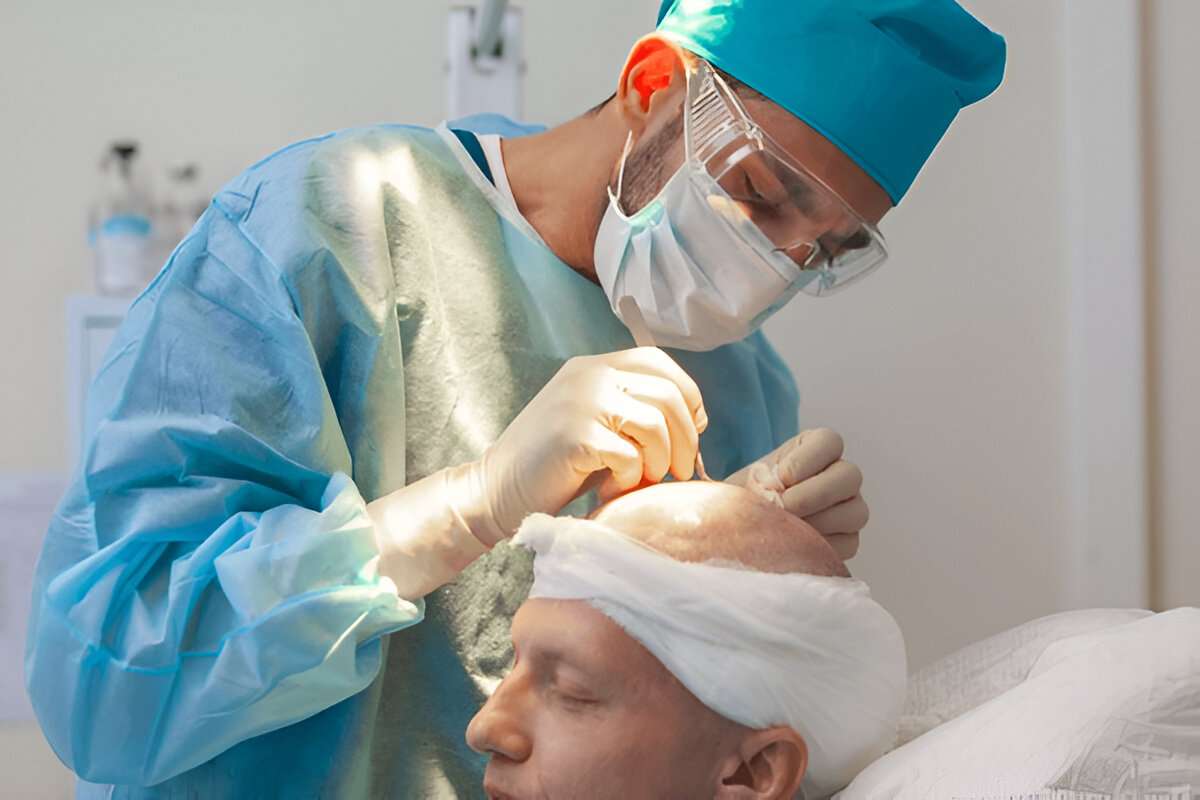 Hair Transplant