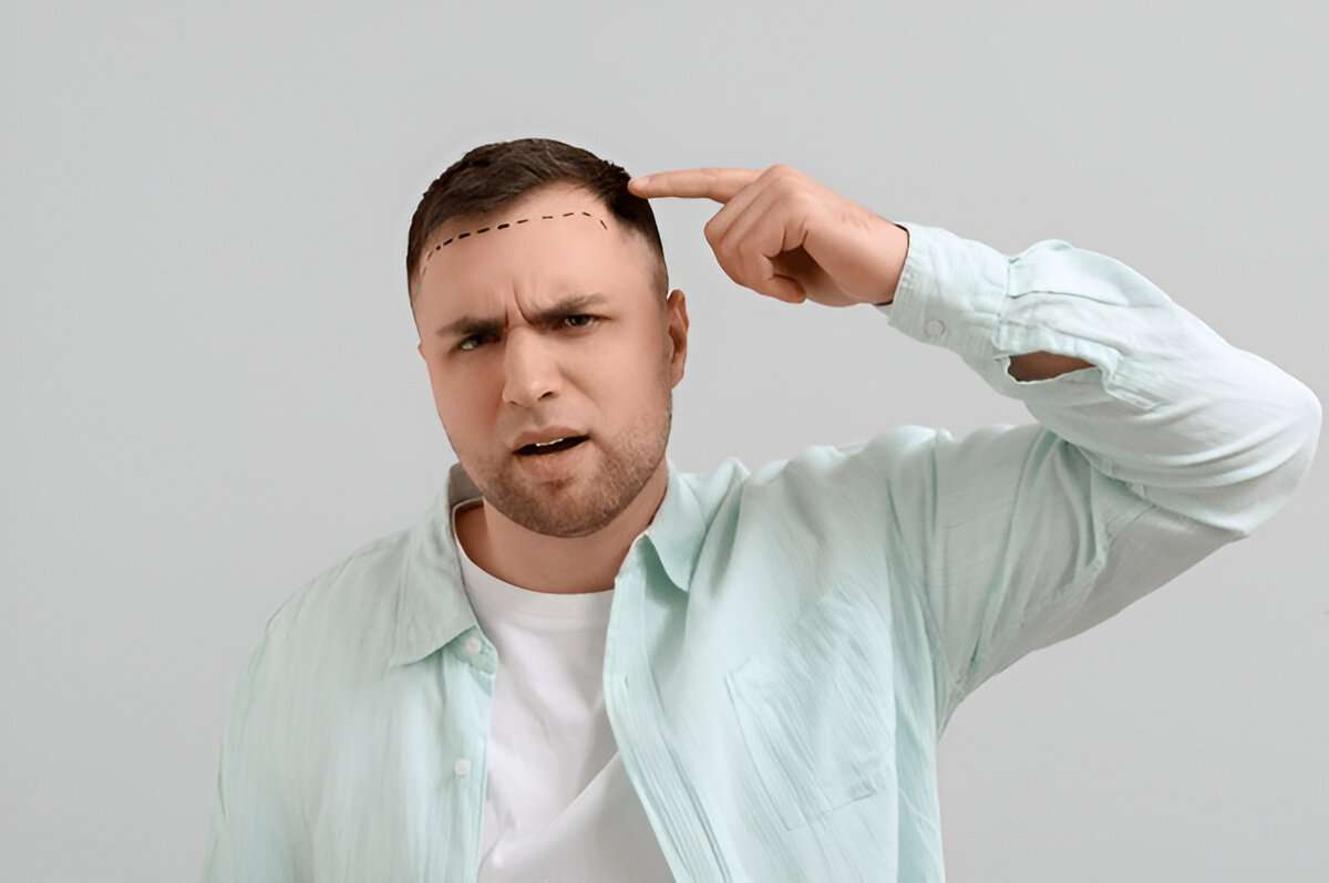 Hair Transplant