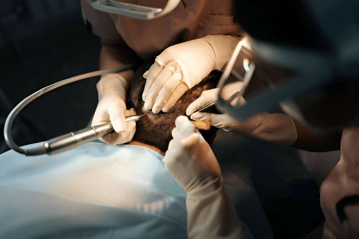 hair transplant Manchester